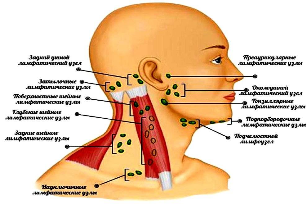 Воспаление лимфоузлов возле уха: причины, симптомы, диагноз, лечение и профилактика