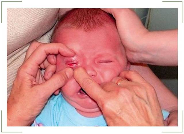 Отит у новорожденного: симптомы и лечение в домашних условиях