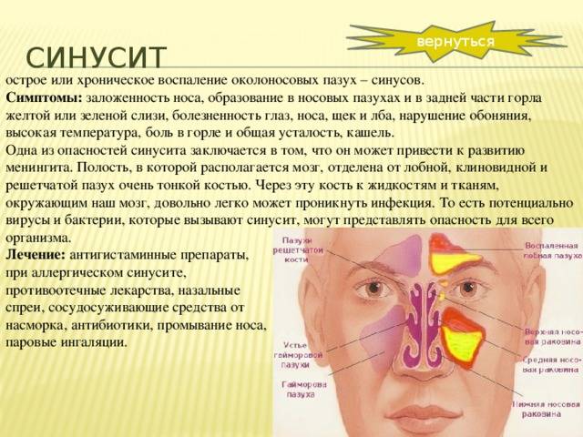 Острый синусит: симптомы и лечение у детей в домашних условиях, что это такое | prof-medstail.ru