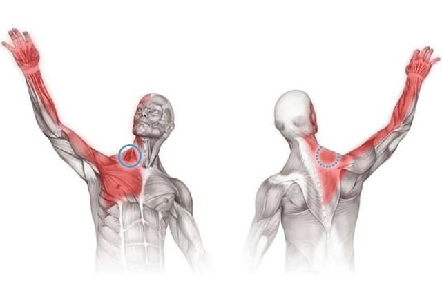 Как лечить неврит плечевого нерва