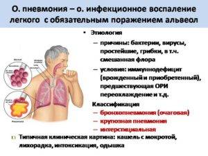 Заразна ли пневмония для окружающих детей: как передается и можно ли заразиться, а также мнение доктора комаровского | fok-zdorovie.ru
