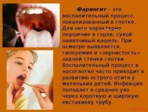 Что делать, если щекочет в горле и вызывает кашель pulmono.ru
что делать, если щекочет в горле и вызывает кашель