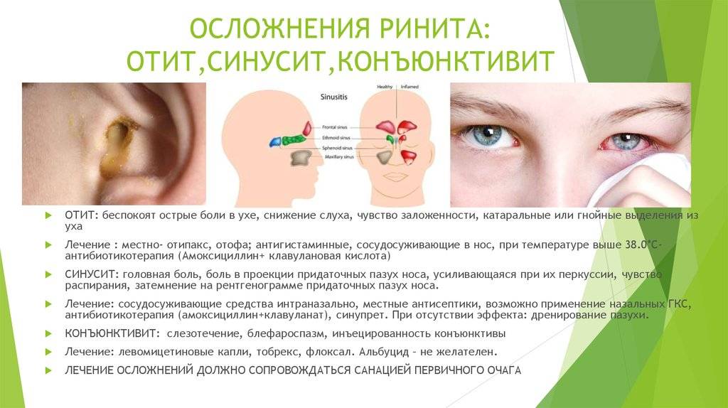 Коронавирус и нос: симптомы, заложенность, сухость