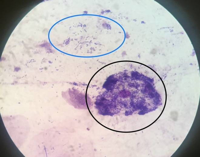 Микроскопический анализ мокроты | компетентно о здоровье на ilive