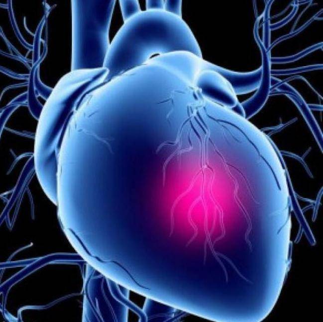 Стенокардия и инфаркт миокарда