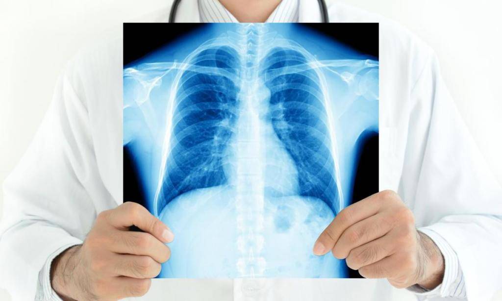 Диагностика туберкулеза у взрослых - методы обследования и выявления