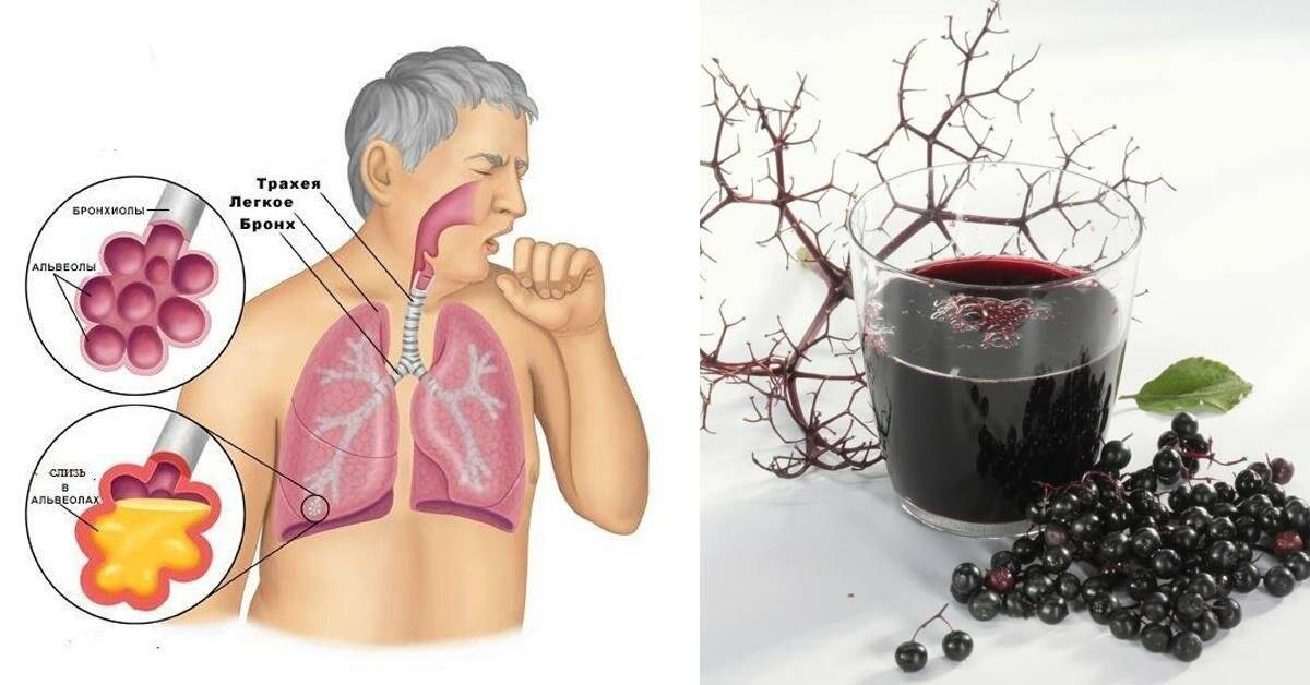 Лечение бронхиальной астмы у взрослых: народные средства, можно ли вылечить?