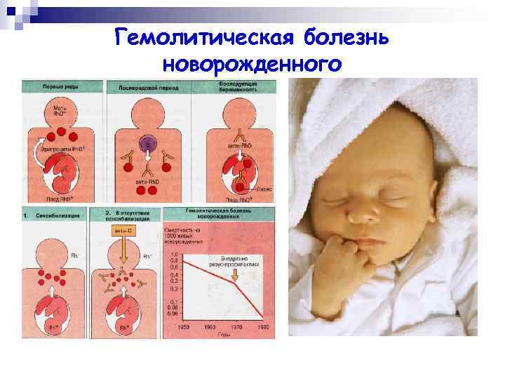 Гемолитическая болезнь новорожденных | компетентно о здоровье на ilive