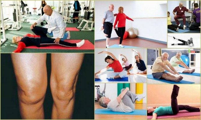 Упражнения при артрозе коленного сустава: комплекс упражнений для дома. видео