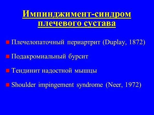 Импиджмент-синдром плечевого сустава
