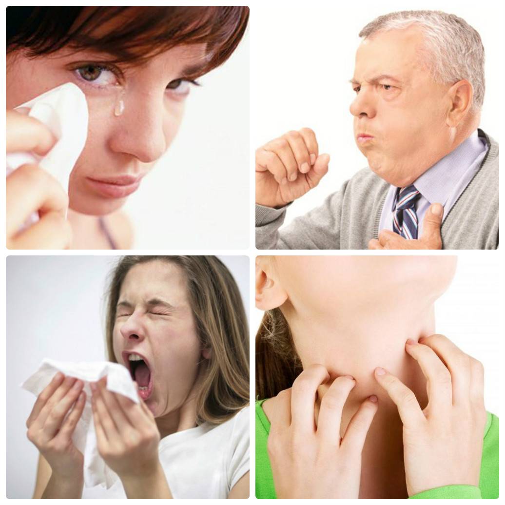 Головная боль сухой кашель насморк. Аллергия чихание и насморк.