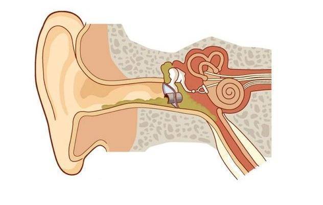 Отит среднего уха у ребенка: от симптомов до лечения