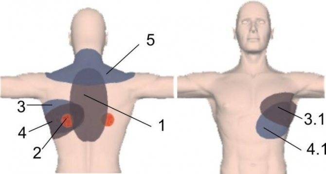 Боль в спине в области ребер и под ними: с правой стороны выше поясницы, слева или с обеих сторон