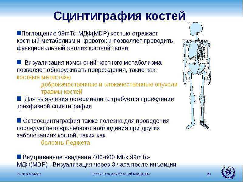 Сцинтиграфия костей скелета: подготовка, проведение и цена обследования