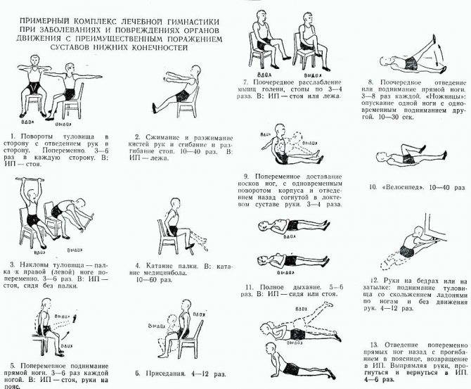 Упражнения при коксартрозе: эффективность, задачи, противопоказания и правила выполнения