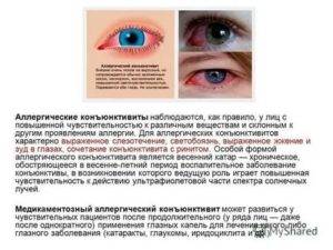 Астенопия глаз
