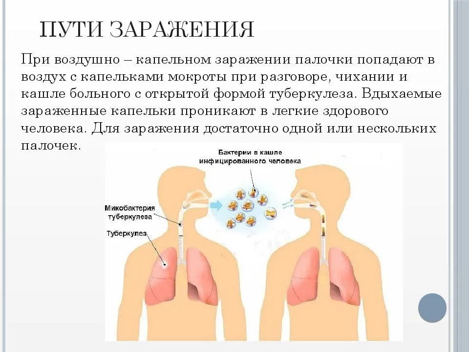 Как передается туберкулез легких от человека к человеку