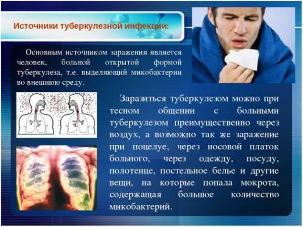 Закрытая форма туберкулеза: можно ли заразиться, симптомы, как передается