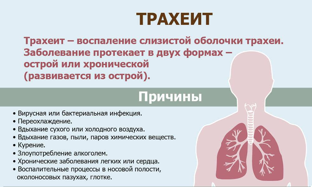 Трахеит: симптомы, лечение, антибиотики. как лечить трахеит
