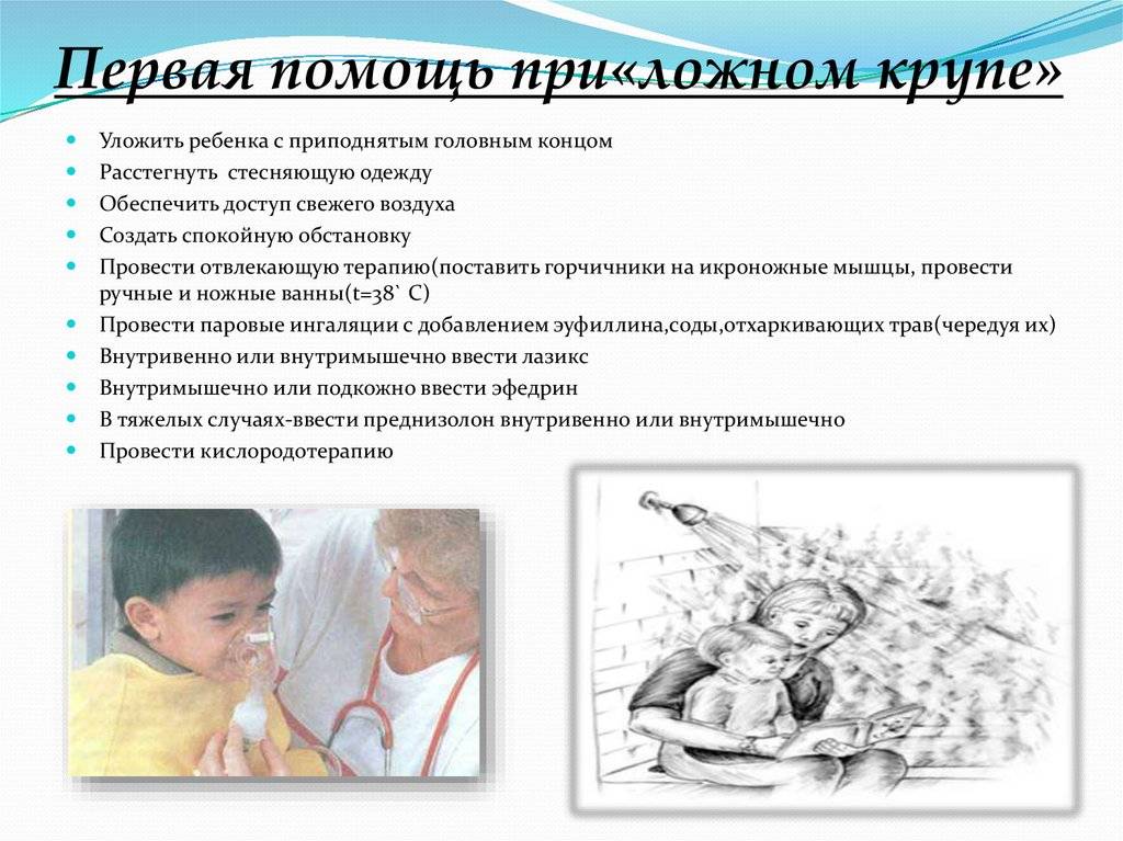 Ложный круп у детей: симптомы и лечение болезни, причины, правила неотложной помощи | заболевания | vpolozhenii.com