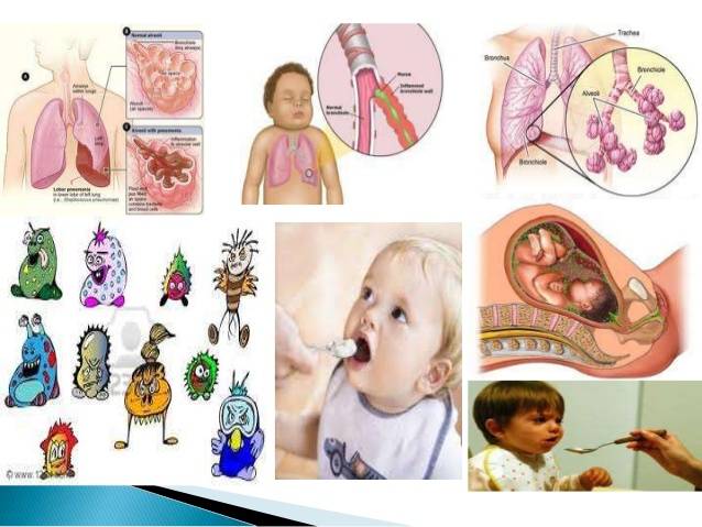 Этиология и признаки пневмонии у детей первого года жизни