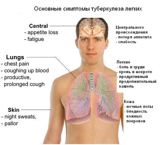 Симптомы и признаки при туберкулезе легких у взрослых: ранние и поздние