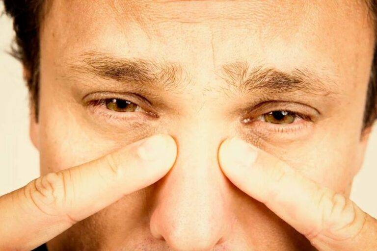 Гайморит - симптомы у взрослых без температуры: лечение насморка в домашних условиях, признаки без заложенности носа и соплей