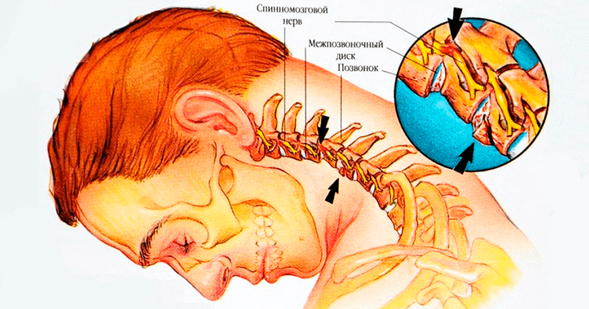 Заложенность ушей головокружение и головная боль