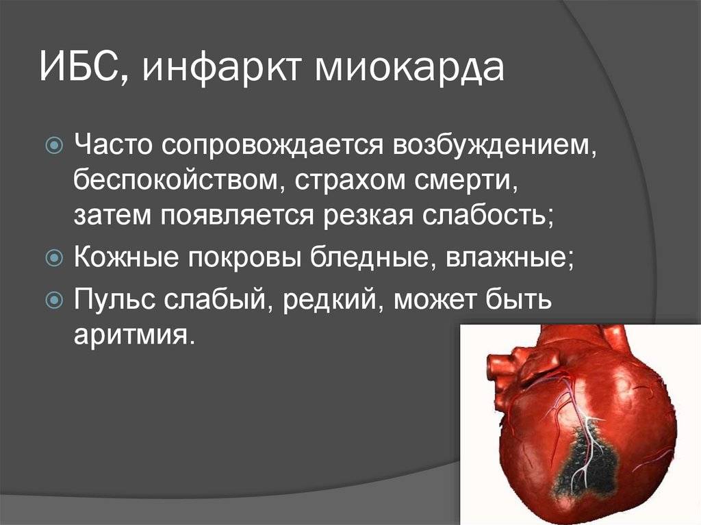 Осложнения инфаркта миокарда: аритмические, механические, воспалительные