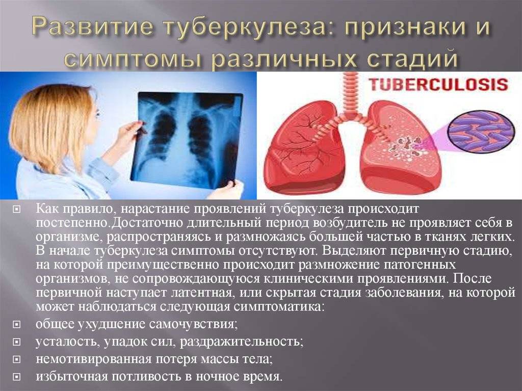 Признаки развития туберкулеза на ранней стадии