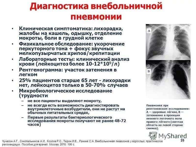 Пневмофиброз легких: что это, последствия и лечение - medside.ru