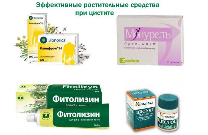 Недорогие таблетки от цистита у женщин: быстрое лечение таблетками, список