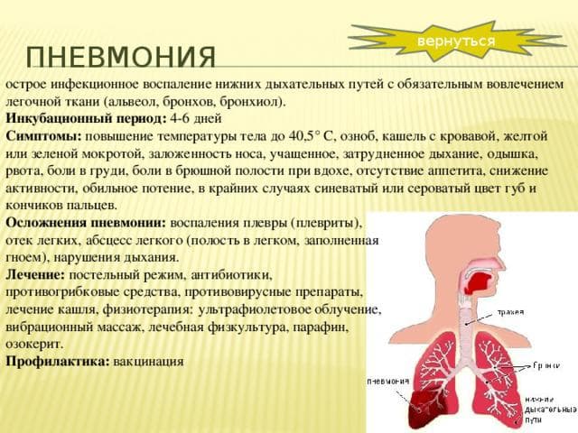 Вирусная пневмония у взрослых и детей – симптомы, признаки, лечение