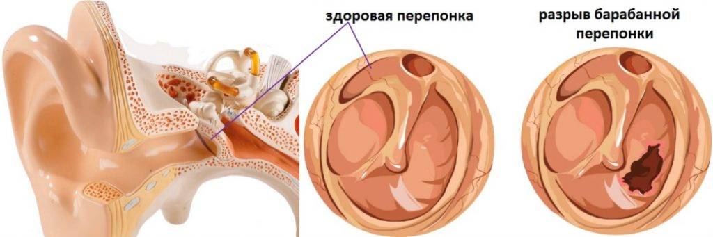 Симптомы отита у грудничка: признаки у грудного ребенка - как распознать и определить отит у новорожденного и ребенка до года, причины появления