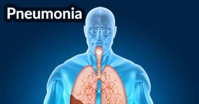 Как лечить пневмонию в домашних условиях?