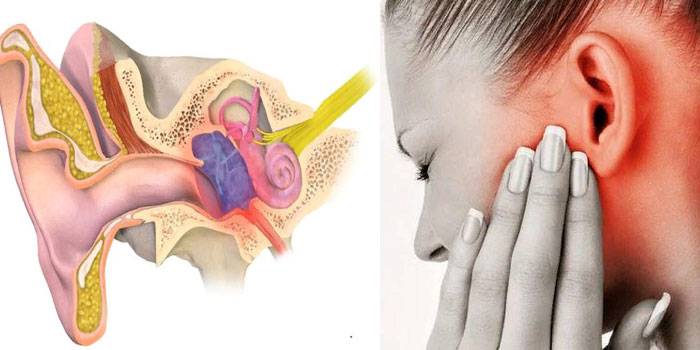 Болит горло и закладывает уши: симптоматика и эффективное лечение