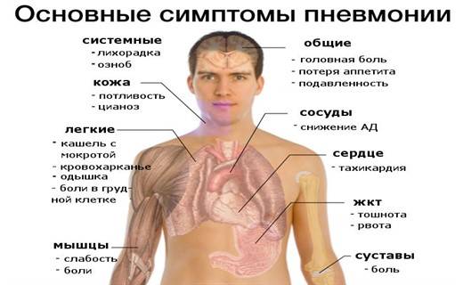Воспаление легких: симптомы у взрослых без температуры, вирусная пневмония, лечение, с кашлем, очаговое, крупозное