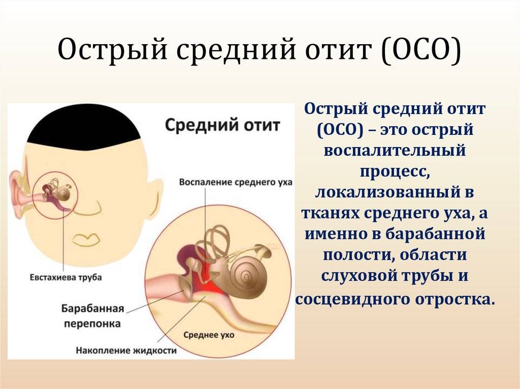 Симптомы отита у ребенка 1 год - wikibolesni.ru