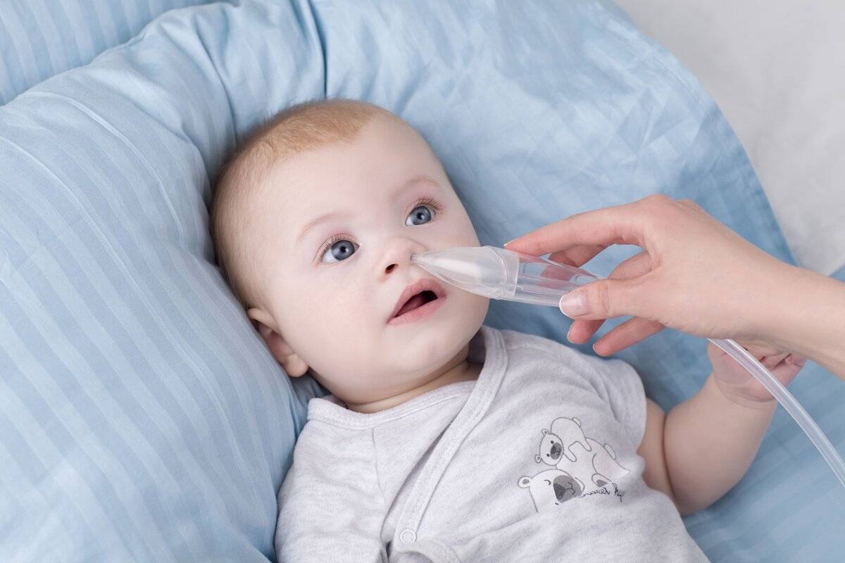 Сильный насморк у ребенка (сопли как вода) – самые действенные методы лечения