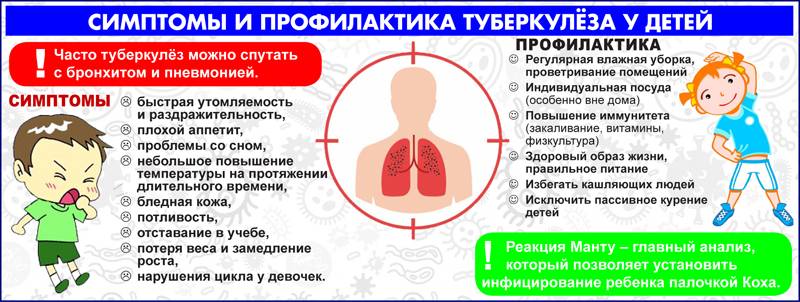 Симптомы туберкулеза на ранних стадиях у ребенка