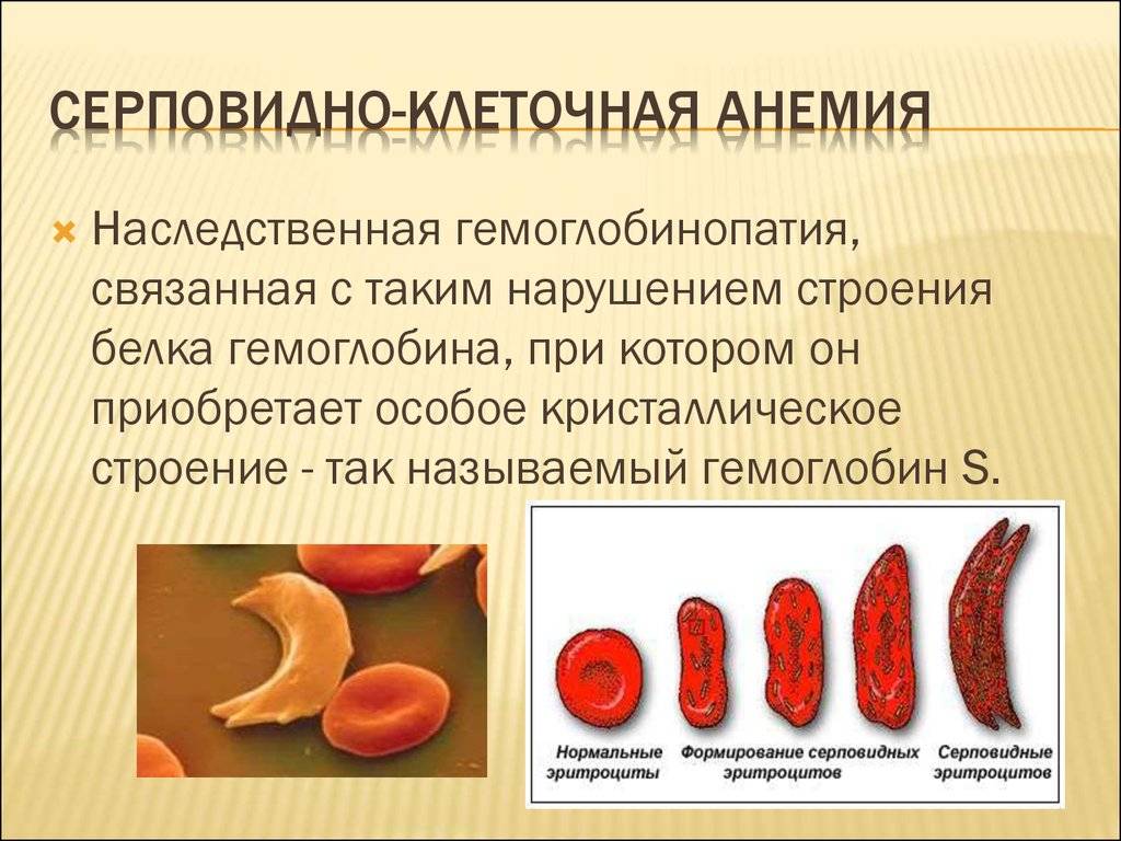 Анемия серповидноклеточная | энциклопедия кругосвет