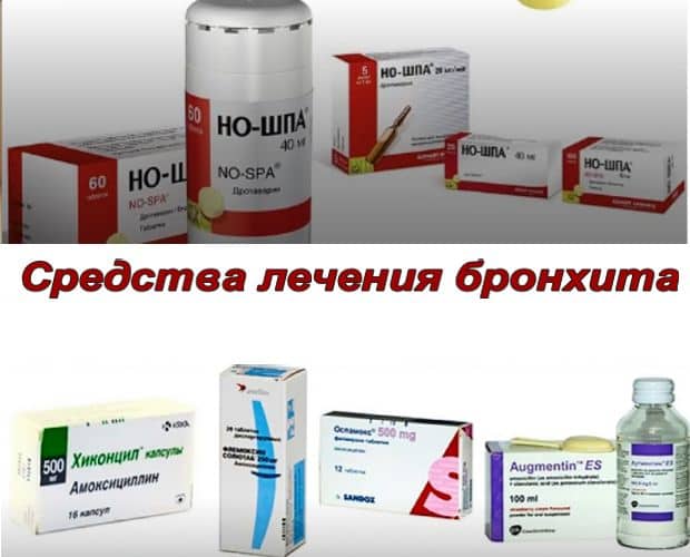 Чем лечить бронхит у взрослых: список лучших лекарств pulmono.ru
чем лечить бронхит у взрослых: список лучших лекарств