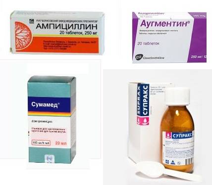 Лекарства для лечения бронхита у взрослых, принимаем эффективные препараты