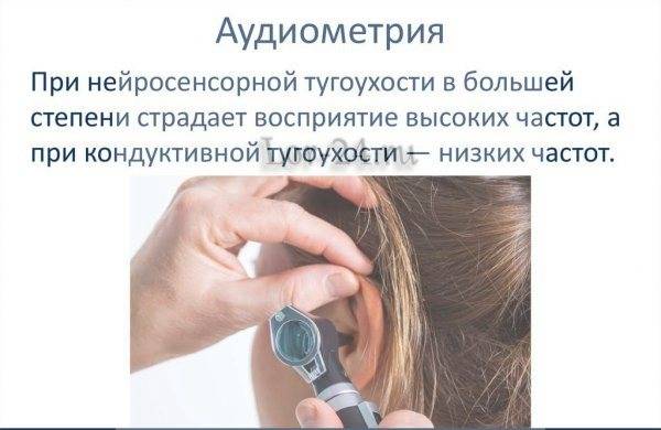 Особенности восстановления слуха при нейросенсорной тугоухости