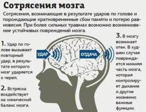 Признаки и лечение ушиба головного мозга