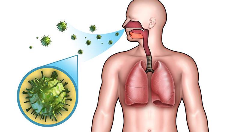 Заразна ли пневмония для окружающих и какими путями передается воспаление легких