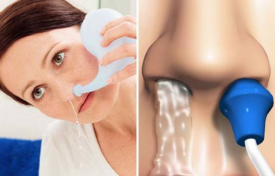 Нужно ли промывать нос при гайморите и чем правильно это делать