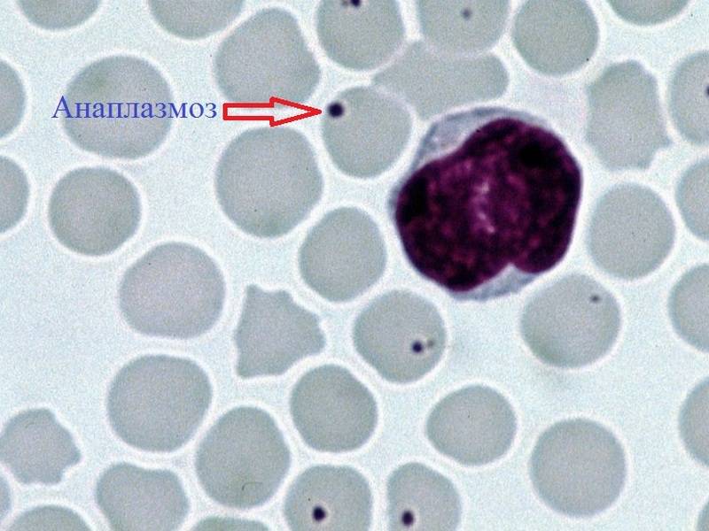 Анализ крови на клещевой энцефалит и боррелиоз в инвитро
