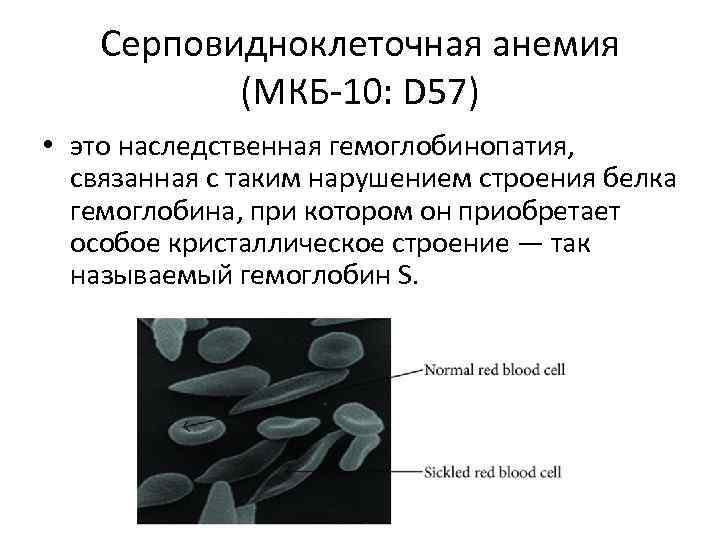 Что такое серповидноклеточная анемия