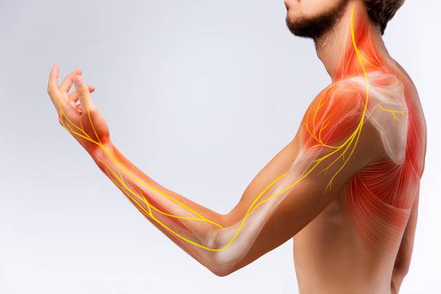 Невралгия плечевого нерва (сплетения): симптомы плексита, диагностика лечение плечевого сустава
